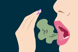 Illustration of bad breath