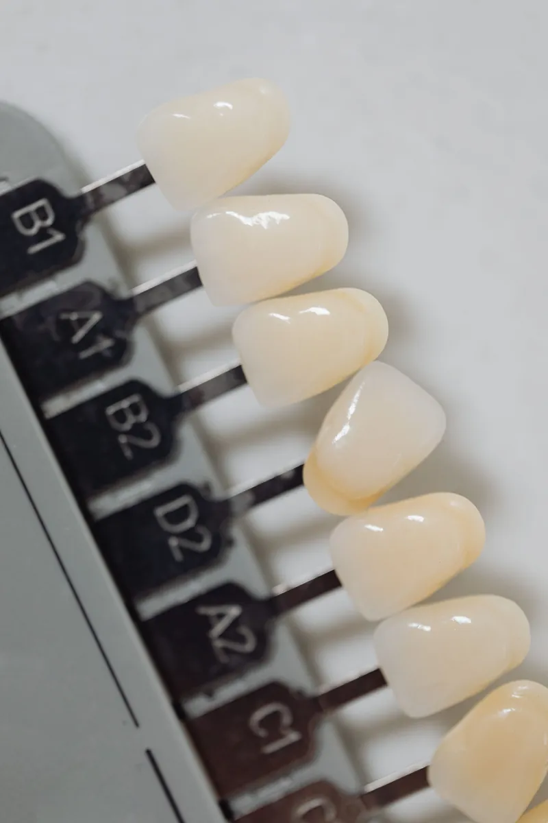 Labelled porcelain shade tabs, from the lightest shades to warmer ones